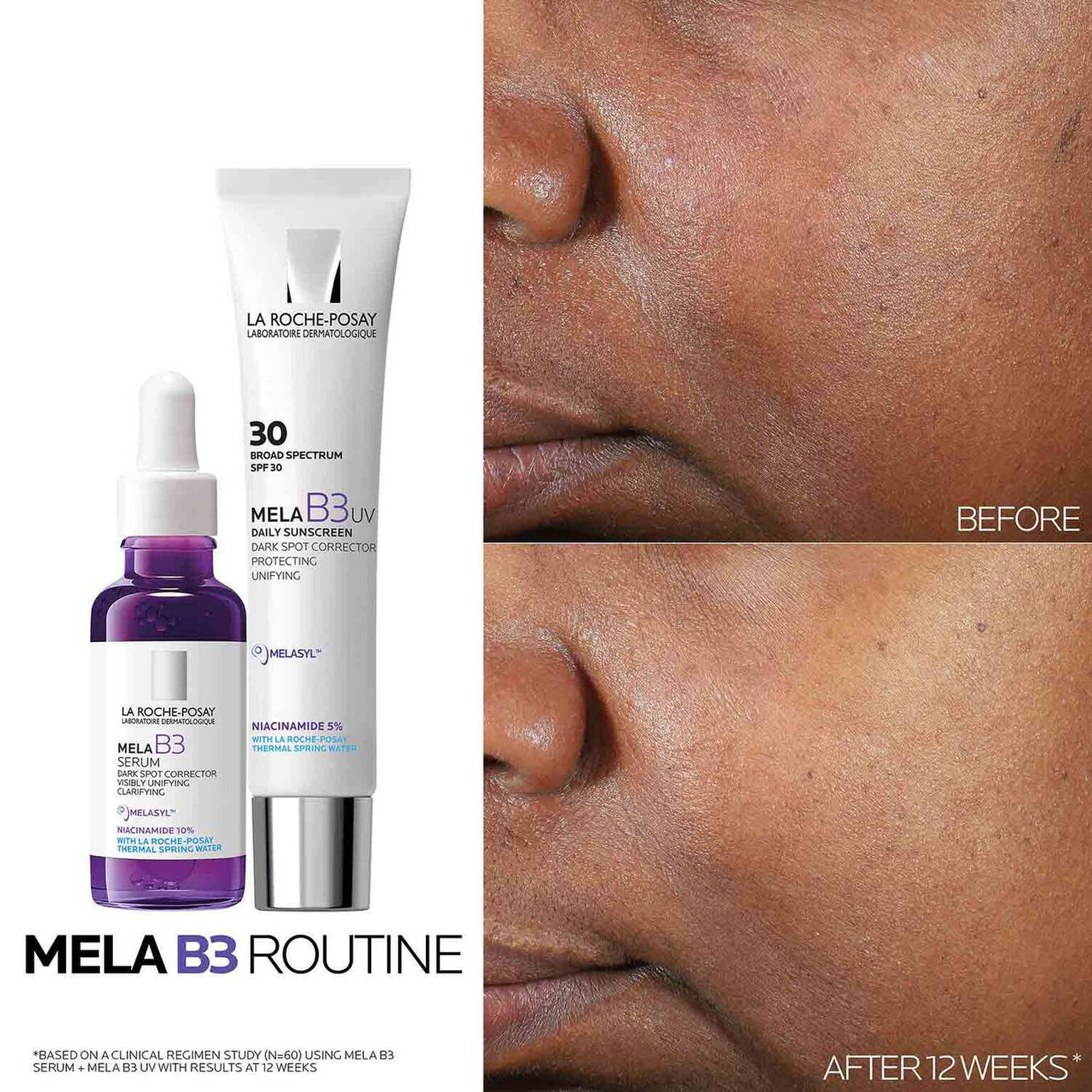 mela-b3-dark-spot-serum-and-mela-b3-uv-daily-moisturizer-with-spf-30-o0 3-Mela-B3-routine_1500X1500.jpg