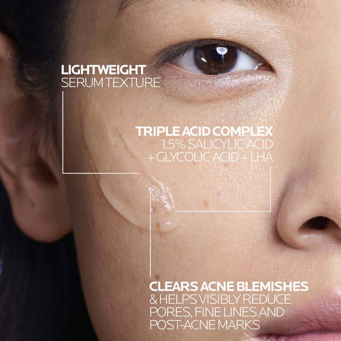 effaclar-salicylic-acid-acne-treatment-serum-v0 LaRochePosay-Product-Effaclar-Effaclar-Serum-30ml-3337875722827-Texture-REV.jpg