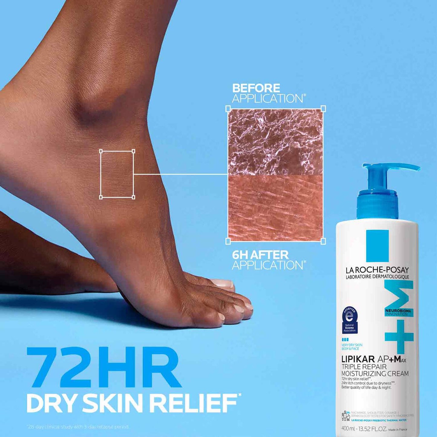 lipikar-ap-max-triple-repair-moisturizing-cream-u8 LaRochePosay-Product-Skincare-Lipikar-Balm-AP+MAX-400ml-3337875941150-ATF-PIM-BeforeAfter.jpg