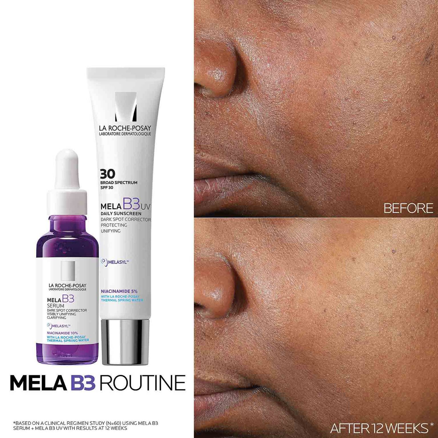 mela-b3-uv-daily-moisturizer-spf-30-with-melasyltm-niacinamide-r7 Mela-B3-routine_1500X1500.jpg